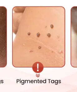 QIAWI™ TagDrop Painless Micro Patch