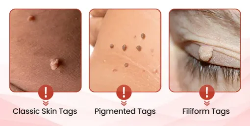 QIAWI™ TagDrop Painless Micro Patch