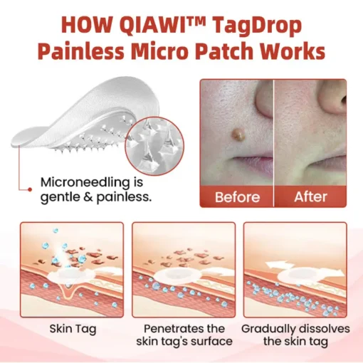 QIAWI™ TagDrop Painless Micro Patch