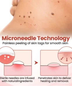 QIAWI™ TagDrop Painless Micro Patch