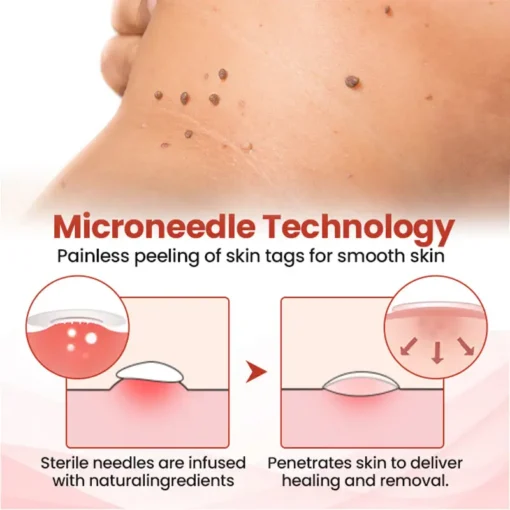QIAWI™ TagDrop Painless Micro Patch