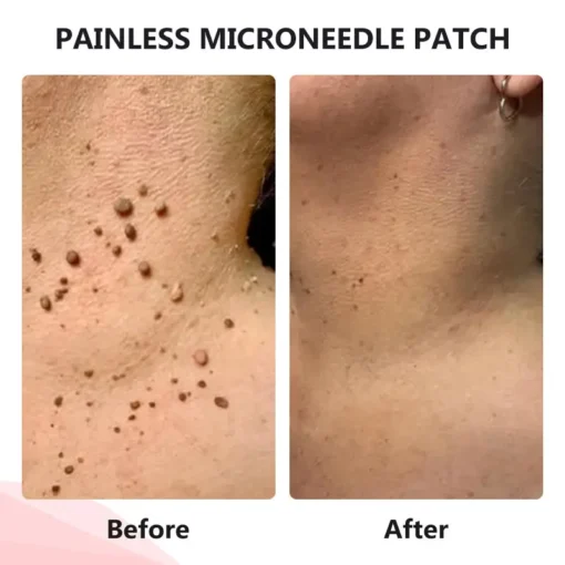 QIAWI™ TagDrop Painless Micro Patch