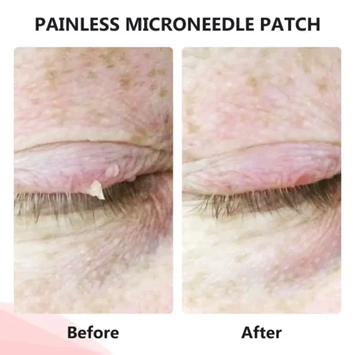QIAWI™ TagDrop Painless Micro Patch