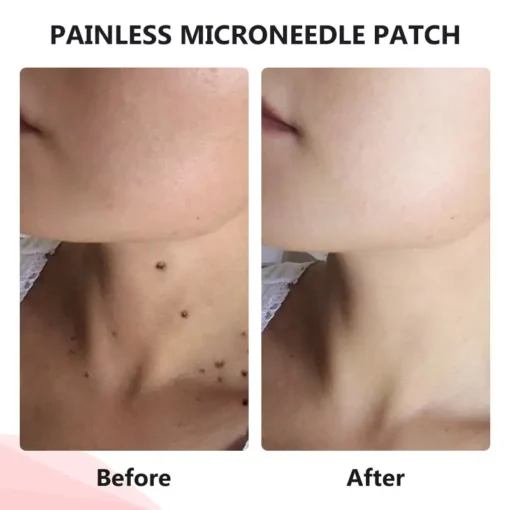 QIAWI™ TagDrop Painless Micro Patch