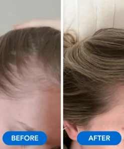 QIAWI™-Hair Growth Serum