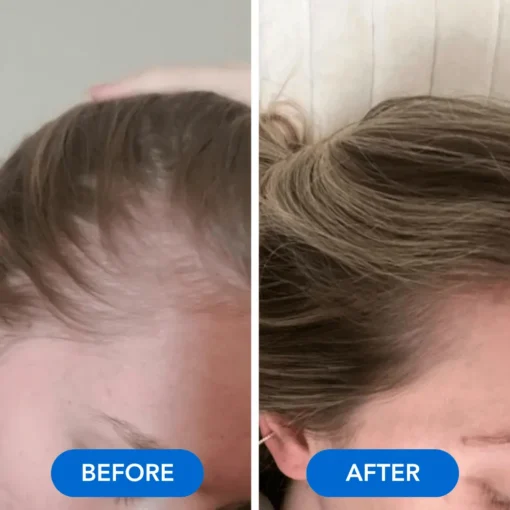 QIAWI™-Hair Growth Serum
