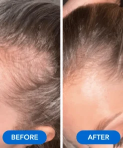 QIAWI™-Hair Growth Serum