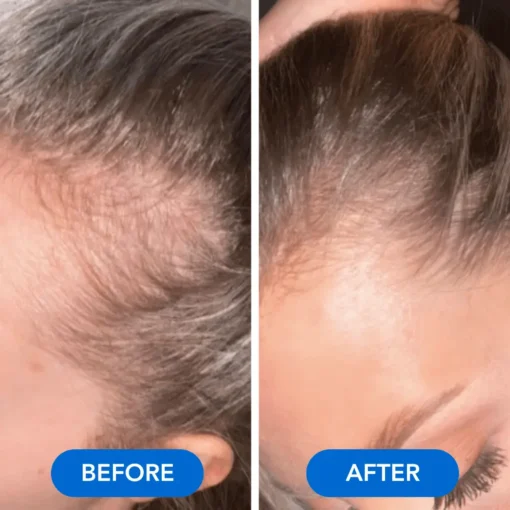 QIAWI™-Hair Growth Serum