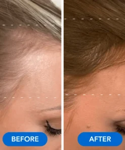 QIAWI™-Hair Growth Serum