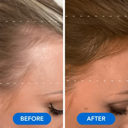 QIAWI™-Hair Growth Serum