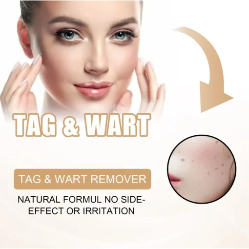 QIAWI™ Skin Tag & Mole Remover