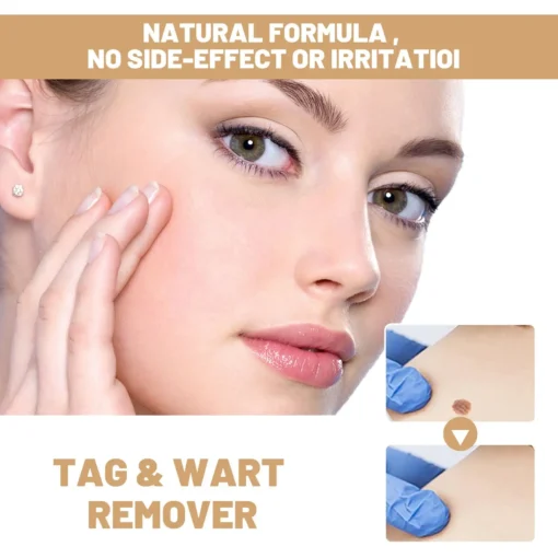 QIAWI™ Skin Tag & Mole Remover
