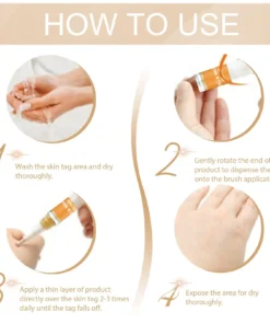 QIAWI™ Skin Tag & Mole Remover