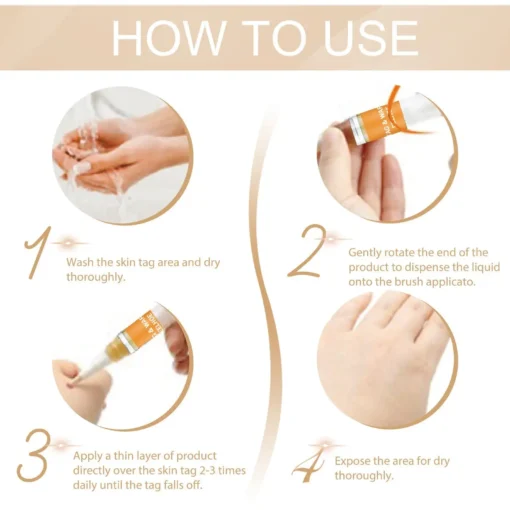 QIAWI™ Skin Tag & Mole Remover