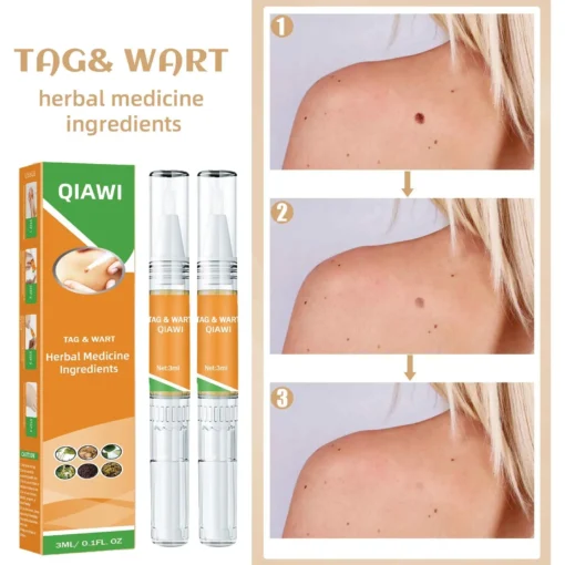 QIAWI™ Skin Tag & Mole Remover