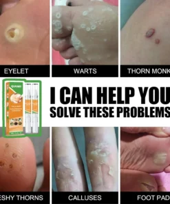 QIAWI™ Skin Tag & Mole Remover