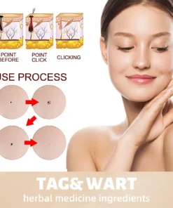 QIAWI™ Skin Tag & Mole Remover