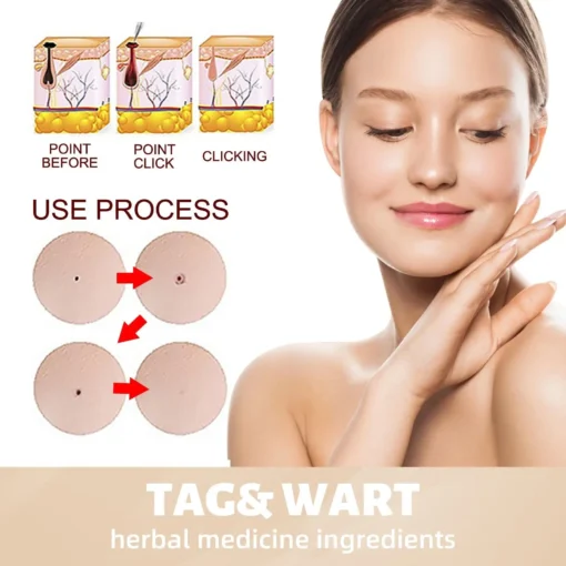 QIAWI™ Skin Tag & Mole Remover