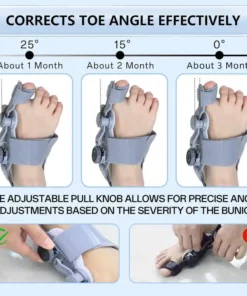 QIAWI™ Toe Alignment Corrector