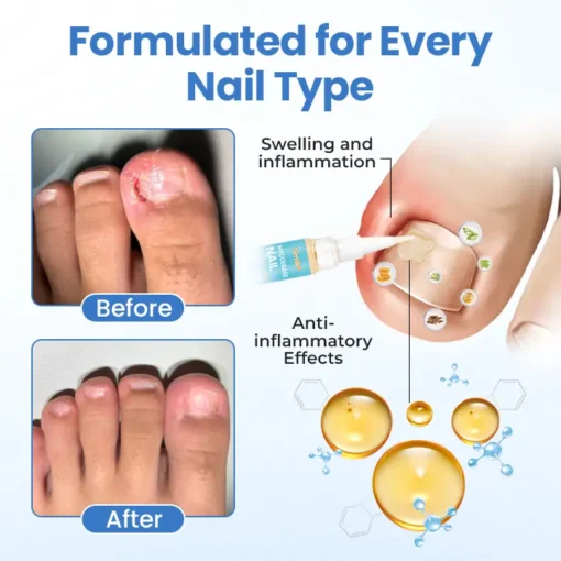 QIAWI® MycoErase Nail Revive Pen