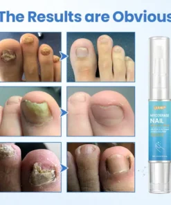 QIAWI® MycoErase Nail Revive Pen