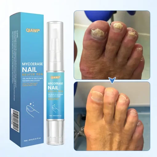 QIAWI® MycoErase Nail Revive Pen