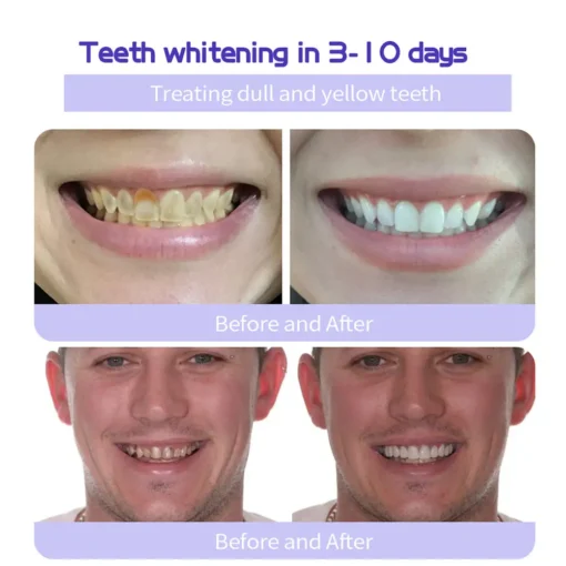 QIAWI™TeethRestoration Mineral Powder