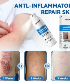 QIAWI Magnesium Herbal Psoriasis Spray