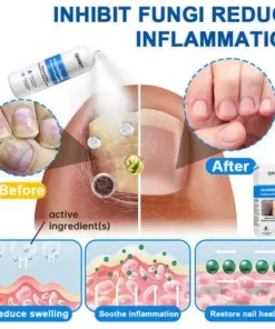 QIAWI Magnesium Herbal Psoriasis Spray