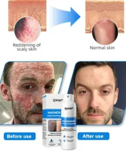 QIAWI Magnesium Herbal Psoriasis Spray