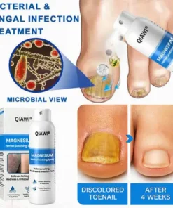 QIAWI Magnesium Herbal Psoriasis Spray