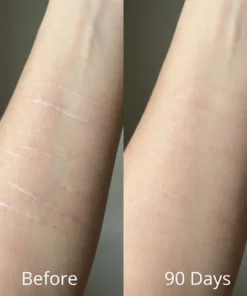 QIAWI Scar removal Silicone stick-Face & Body