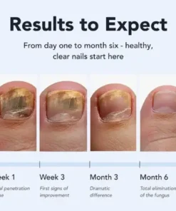 QIAWI Antifungal Pen