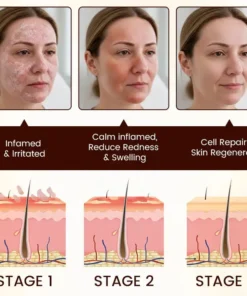 QIAWI Bee Venom Multi-Symptom Treatment Cream