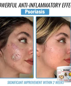 QIAWI Bee Venom Multi-Symptom Treatment Cream