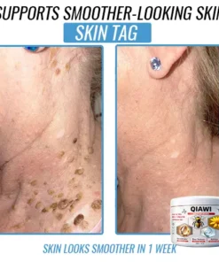 QIAWI Bee Venom Multi-Symptom Treatment Cream