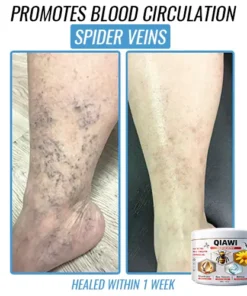 QIAWI Bee Venom Multi-Symptom Treatment Cream