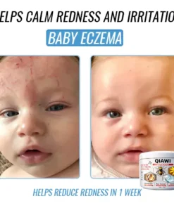 QIAWI Bee Venom Multi-Symptom Treatment Cream