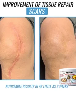 QIAWI Bee Venom Multi-Symptom Treatment Cream