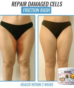 QIAWI Bee Venom Multi-Symptom Treatment Cream