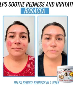 QIAWI Bee Venom Multi-Symptom Treatment Cream