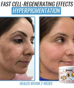 QIAWI Bee Venom Multi-Symptom Treatment Cream