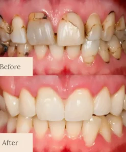 QIAWI® Teeth Armor Drops