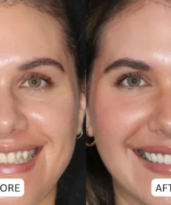 QIAWI® Teeth Armor Drops