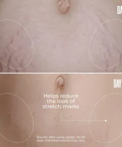 QIAWI® Tighten & Smooth Belly Cream