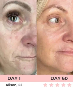 QIAWI 7-in-1 LED Facial Sculptor