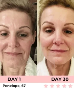 QIAWI 7-in-1 LED Facial Sculptor