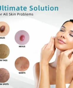 QIAWI™ All-in-One CO₂ Laser Eraser Pen Removes Moles, Warts, Skin Flaws Pigmentation