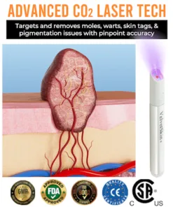 QIAWI™ All-in-One CO₂ Laser Eraser Pen Removes Moles, Warts, Skin Flaws Pigmentation