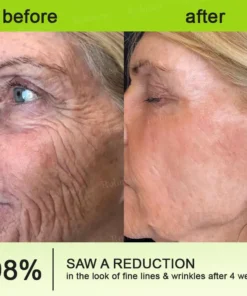 QIAWI™ Botulinum & Vita-A Retinol Shot Wrinkle-Lift Tightening cream